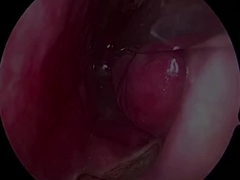 一回使用可能な超小型で柔軟な神経学探査機 PLA407